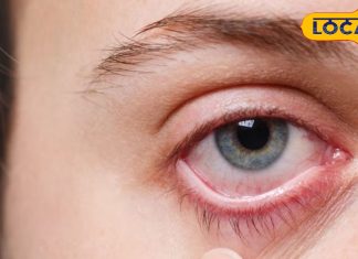 Summer Eye Care Tips: गर्मियों में आंखों को इंफेक्शन से बचाने के लिए जरूर फॉलो करें डॉक्टर की ये जरूरी टिप्स!