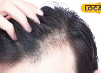 सिरदर्द बना बालों का झड़ना? बस इस घरेलू तेल को लगाइए, जड़ें होंगी मजबूत और ग्रोथ भी जबरदस्त