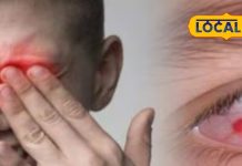 आंखें जल रही हैं, पानी आ रहा है? अगर ये लक्षण दिखें तो तुरंत करें ये उपाय