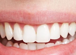 Lucky Teeth: ऐसे दांत वाले लोग होते हैं खतरनाक, जो कहते हैं, वो हो जाता है सच! जानें आपकी कैसी पर्सनालिटी