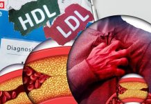 धमनियों से बैड कोलेस्ट्रॉल चूस लेंगी ये 5 हरी चटनी! दवा का करती हैं काम