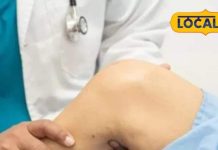 खिलाड़ियों की चोटों के लिए फिजियोथेरेपी के फायदे – डॉ. ऋषिकेश पोल