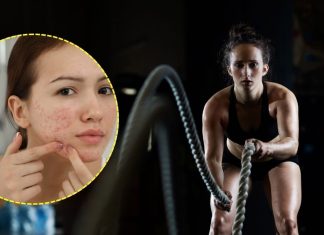 Gym Skin Care: जिम में पसीना बहाते ही चेहरे पर हो जाते हैं पिंपल्स-एक्ने? 4 गलतियां हैं वजह, कभी न करें ये मिस्टेक!