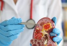 इन 5 वजहों से बढ़ रहीं किडनी की बीमारियां ! वक्त रहते सुधार लें आदतें, वरना कम उम्र में ही बन जाएंगे मरीज