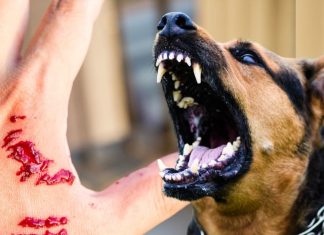 कुत्ते के काटने ही नहीं, चाटने से भी हो सकती है रेबीज ! ये जानवर भी फैलाते हैं यह जानलेवा बीमारी, ऐसे करें बचाव