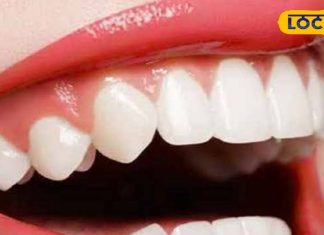 दांतों पर जमा पीलापन होगा तुरंत गायब, इन घरेलू नुस्खे को आजमाएं