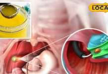 बिना ऑपरेशन खत्म होगी पित्त की थैली की पथरी! इस सुपरफूड को कर लें डाइट में शामिल