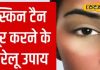 तपती धूप में चेहरा पड़ गया है काला, लगा लें ये लेप, चमक उठेगी सूरत – Bharat.one हिंदी