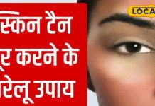 तपती धूप में चेहरा पड़ गया है काला, लगा लें ये लेप, चमक उठेगी सूरत – Bharat.one हिंदी