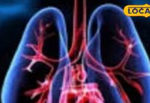 साधारण खांसी-जुकाम समझकर नजरअंदाज न करें ये लक्षण, ये हो सकती है फेफड़ों में पानी भरने की शुरुआत