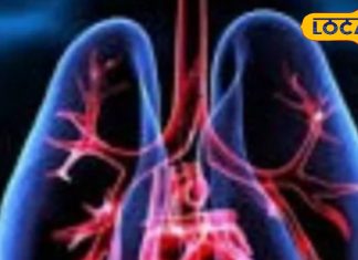 साधारण खांसी-जुकाम समझकर नजरअंदाज न करें ये लक्षण, ये हो सकती है फेफड़ों में पानी भरने की शुरुआत