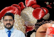 नाक-मसूड़ों से लगातार आता है खून? मामूली चोट पर भी नहीं रुकता ब्लड फ्लो? कहीं हीमोफीलिया तो नहीं! डॉक्टर ने दी सलाह