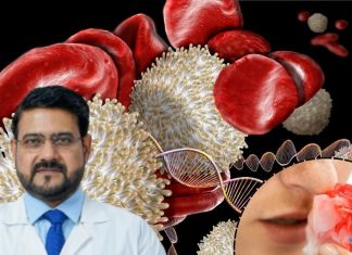 नाक-मसूड़ों से लगातार आता है खून? मामूली चोट पर भी नहीं रुकता ब्लड फ्लो? कहीं हीमोफीलिया तो नहीं! डॉक्टर ने दी सलाह