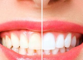 क्या मोतियों जैसे चमकते दांत सेहत के लिए ठीक है? सच्चाई जान हिल जाएंगे आप, अगर ऐसा है तो फिर अलर्ट हो जाएं