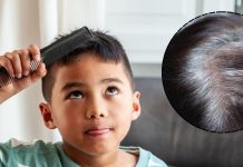 “डॉक्टर, मेरे बच्चे के बाल सफेद क्यों हो रहे?” क्या आप भी इस सवाल का जवाब चाहते हैं! यहां जानें वजह और उपाय