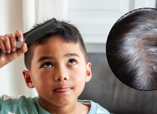 “डॉक्टर, मेरे बच्चे के बाल सफेद क्यों हो रहे?” क्या आप भी इस सवाल का जवाब चाहते हैं! यहां जानें वजह और उपाय