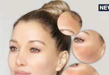 चेहरे पर आने वाली झाइयों को कैसे हटाएं? शहद में मिलाकर लगाएं ये 5 चीजें, बुढ़ापे तक बना रहेगा कुदरती ग्लो!