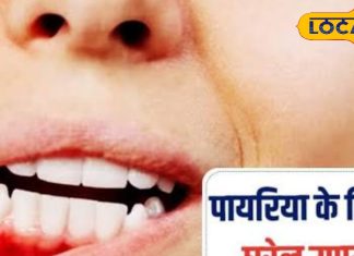 दांतों को खोखला कर देती है ये बीमारी, ऐसे पहचानें शुरुआती संकेत, एक्सपर्ट से जानें घरेलू इलाज
