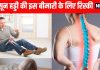 बारिश में Osteoporosis के मरीज हड्डियों की देखभाल कैसे करें, क्या बरतें सावधानियां