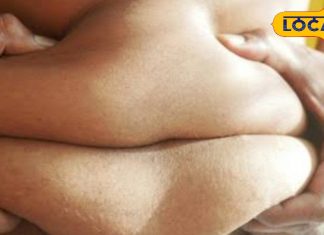 Weight Loss Tips: लटकती तोंद हो जाएगी छूमंतर, बस कर लें ये काम, डॉक्टर्स ने भी माना लोहा