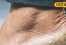 सुंदर और मुलायम पैर चाहिए तो अपनाइए ये 6 आसान टिप्स, फटी एड़ियों से भी मिलेगा छुटकारा