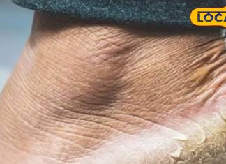 सुंदर और मुलायम पैर चाहिए तो अपनाइए ये 6 आसान टिप्स, फटी एड़ियों से भी मिलेगा छुटकारा