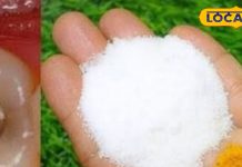 Dental Care Tips: दांतों के दर्द से हैं परेशान, तो किचन में मौजूद इन चीजों का कर लें इस्तेमाल..यकीन मानें मिनटों में मिलेगा आराम