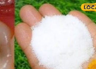 Dental Care Tips: दांतों के दर्द से हैं परेशान, तो किचन में मौजूद इन चीजों का कर लें इस्तेमाल..यकीन मानें मिनटों में मिलेगा आराम