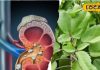 Health Tips: पथरी का दुश्मन है ये जादुई पौधा! त्वचा से लेकर दांतों तक, पूरी शरीर को बना देगा झट से तंदुरुस्त