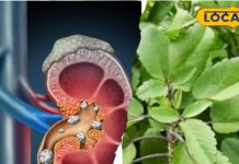 Health Tips: पथरी का दुश्मन है ये जादुई पौधा! त्वचा से लेकर दांतों तक, पूरी शरीर को बना देगा झट से तंदुरुस्त