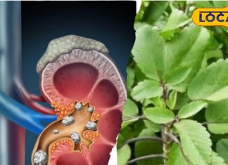 Health Tips: पथरी का दुश्मन है ये जादुई पौधा! त्वचा से लेकर दांतों तक, पूरी शरीर को बना देगा झट से तंदुरुस्त