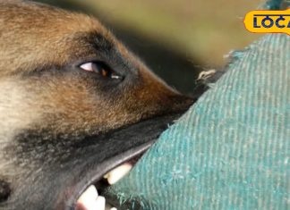 Dogs Bite case Follow these easy tips and step to stay fit know everything from experts – Uttar Pradesh News