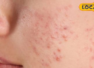 चेहरे की हर समस्या का हल नाभि में, रोज बस 5 बूँद लगाइए तिल या नारियल तेल, सिर्फ 7 दिन में आएगा कुदरती ग्लो