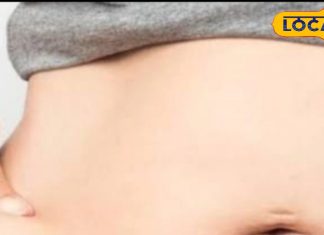 पेट साफ रखने का देसी नुस्खा! मिनटों में मिलेगी राहत, आयुर्वेदिक डॉक्टर ने बताई गजब डाइट