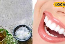 दांतों का पीलापन हटाने के 5 असरदार और प्राकृतिक घरेलू उपाय