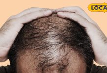 Hair Fall Causes: शैंपू और तेल लगाने में आप भी कर रहे हैं यह गलती, तो बहुत जल्द झड़ जाएंगे सारे बाल, अपनाएं ये घरेलू नुस्खा