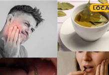 दांत दर्द के घरेलू उपाय: नमक पानी, लौंग, हल्दी, प्याज, तेज पत्ता