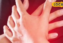Cardiac Arrest Symptoms: कार्डिएक अरेस्ट तब होता है जब…शरीर के इस हिस्से में सबसे पहले दिखते हैं संकेत, 95% लोग करते इग्नोर!
