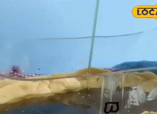 न ऑपरेशन की जरूरत, न खानी पड़ेगी टेबलेट…आयुर्वेद का ये तरीका चुटकियों में भगा देगा स्पाइन दर्द – Uttar Pradesh News