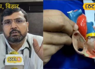 world heart day 2025: हार्ट अटैक आते ही काम करेगी सिर्फ 1 रुपए की ये गोली! बिहार के हार्ट स्पेशलिस्ट डॉक्टर ने बताया रामबाण फार्मूला – Bihar News