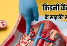 Expert warn 6 unaware little known signs of silent cancer | рдПрдХреНрд╕рдкрд░реНрдЯ рдХреЗ рд╣рд┐рд╕рд╛рдм рдЕрдирд╕реБрд▓рдЭреЗ рдХреИрдВрд╕рд░ рдХреЗ рд╕рдВрдХреЗрдд