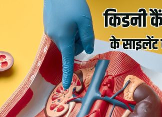 Expert warn 6 unaware little known signs of silent cancer | एक्सपर्ट के हिसाब अनसुलझे कैंसर के संकेत