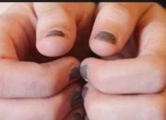 बालायाम योग क्या है और बालों के लिए इसके फायदे व सच्चाई.