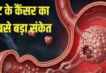 पेट में कैंसर के सबसे बड़ा संकेत कौन सा है, इन 5 लक्षणों को इग्नोर करेंगे तो बर्बाद हो सकती है जिंदगी, अगर हैं तो तुरंत करें इलाज