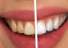 Hari pattiyan effective for teeth yellowing | मोतियों की तरह चमकेंगे दांत! रोज सुबह इन पत्तियों को चबाना कर दीजिए शुरू, महंगे टूथपेस्ट कि नहीं पड़ेगी जरूरत