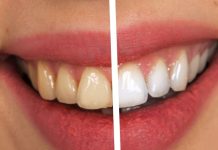 Hari pattiyan effective for teeth yellowing | मोतियों की तरह चमकेंगे दांत! रोज सुबह इन पत्तियों को चबाना कर दीजिए शुरू, महंगे टूथपेस्ट कि नहीं पड़ेगी जरूरत