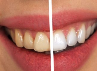 Hari pattiyan effective for teeth yellowing | मोतियों की तरह चमकेंगे दांत! रोज सुबह इन पत्तियों को चबाना कर दीजिए शुरू, महंगे टूथपेस्ट कि नहीं पड़ेगी जरूरत