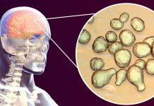 दिमाग खाने वाले अमीबा ने ले ली शख्स की जान, केरल में एक महीने में छठी मौत, जानिए कैसे हुई मौत की पुष्टि