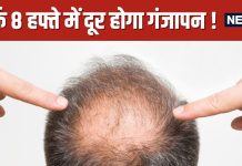 Scientists Developed PP405 Medicine for Hair Regrowth Cure for Baldness | वैज्ञानिकों ने बनाई गंजेपन की दवा, सिर्फ 8 हफ्ते में गंजापन गायब