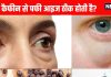 How to get rid of puffy eyes with caffeine: क्या कैफीन से पफी आइज ठीक होती हैं? जानें कारण और घरेलू उपचार